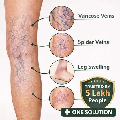 Bee Venom Spider Veins Spray 🔥 Buy 1 Get 1 Free 🔥
